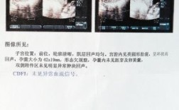 153天是几个月？怀孕10周6天等多少天