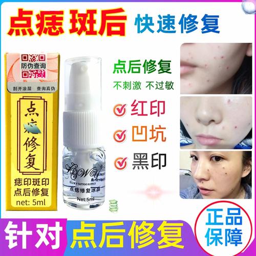 萍乡点痣哪里比较好呀?萍乡点痣哪种好激光多少钱-图2 萍乡点痣哪里比较好呀?萍乡点痣哪种好激光多少钱-图2