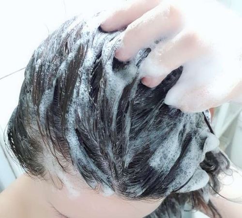 头发有白泥用什么洗发水?白泥可以烧多少温度-图1 头发有白泥用什么洗发水?白泥可以烧多少温度-图1