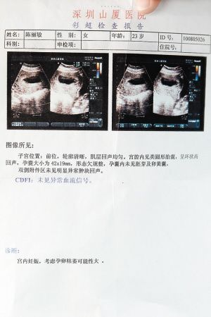 153天是几个月?怀孕10周6天等多少天-图1 153天是几个月?怀孕10周6天等多少天-图1